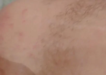 Masturbation