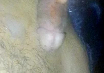 Boy Roasts His Straw and Smears It All Over His Stomach at Night While His Parents Are Away