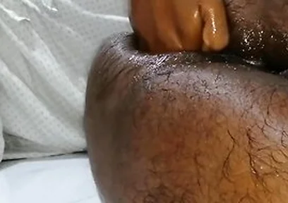 තම පකට තම අතමය පටටම ෆසටන එකක කර වදනව Extreme Self Fisting Best One Ever Huge Cum Load