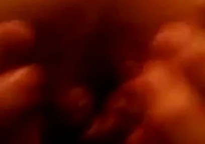 My First Anal Prolapse Video That I Shot