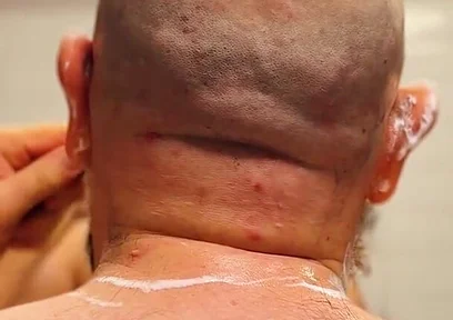 Shave Bald Head and Worship