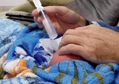60cc Saline Injection in Each Egg