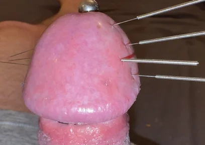 Needles Through the Thick, Hard Glans, Mega Orgasm