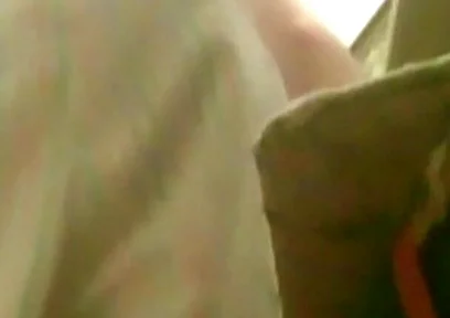 A Young Guy Is Sitting on a Chair with Anal Prolapse