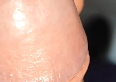 Extreme Application to the Syringe Inside the Glans!!