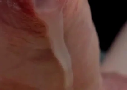 Phimosis Cock Leaking Cum Close-up Hands-free