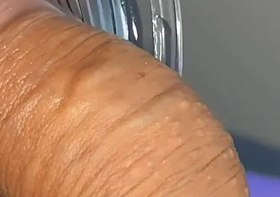 Mysterious Solution Inserted Into the Wrinkled Cock.
