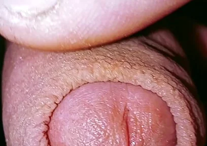 Caress and Suck a Small