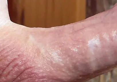 Small Hairless Virgin Phimosis Dick Braves the Cold for Some Hands-free Edging and Leaking Cum