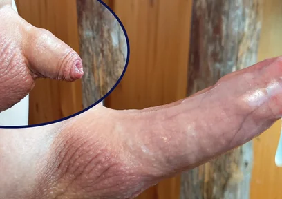 Small Hairless Virgin Phimosis Dick Braves the Cold for Some Hands-free Edging and Leaking Cum