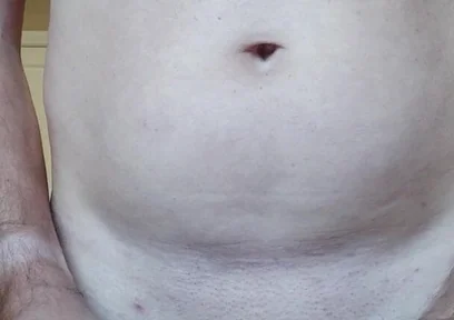 Dilatator