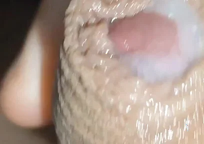 I Have the Largest Ejaculating Phimosis in the World!!