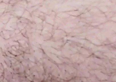 Smoking on the Fist Day 2026