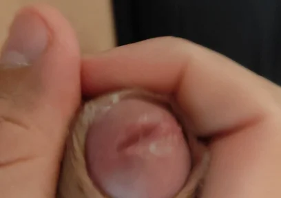 Amazing Pre Cum Glans.