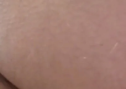 Hairyasslittledick