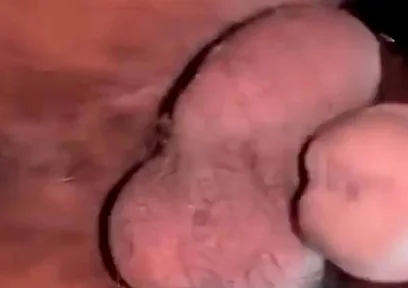 I've Got a Surprise for You Bro