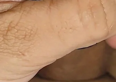 Electrical Pulsation Within the Glans with Rapid Excitation.