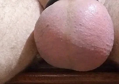 Saline and Masturbation