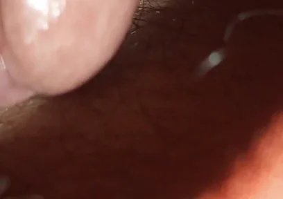 Super Anal