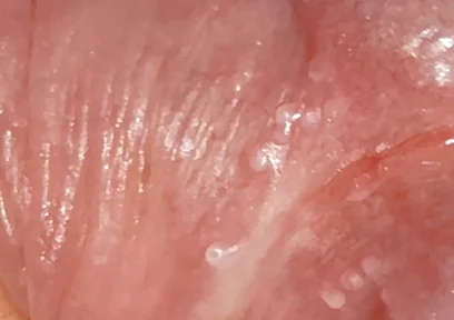 Wide Hole Filled with Pre Cum in Close up