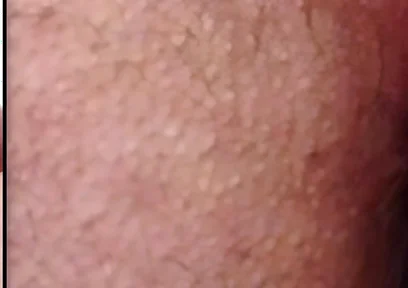 Split-screen Twitching Asshole Dripping with Massive Cum Load