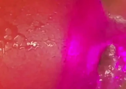 What a Blow Hole