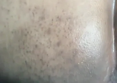 Xl Butt Plug Destroys My Ass