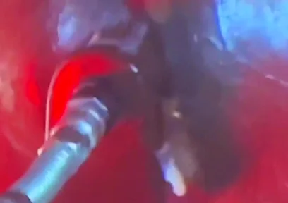 Intense Verbal Play Ahead...