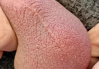 Big Uncut Cock Edging and Cumming, Outdoor Onesie Wank for the Neighbours - Rockardglans