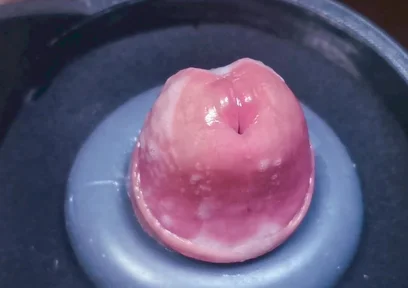 Penis Machine with a New Attachment