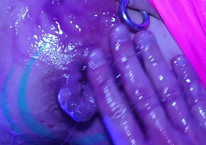 Axelabysse Very Berry