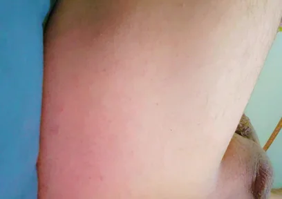 Widening the Ass Opening for Easy Orgasm.