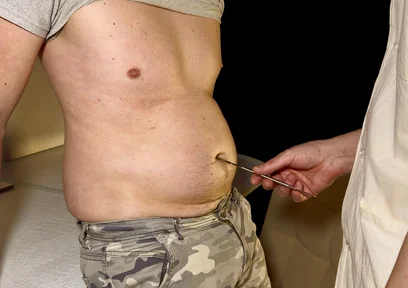 Swollen Perfection - Private Check-up