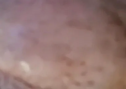 Extreme Fillings Inside My Siliconemeat