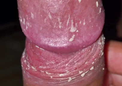 Checking My Dirty Dick