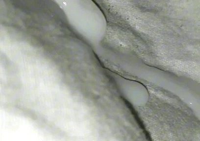 Huge Sperms Out of His Penis, an Young Boy