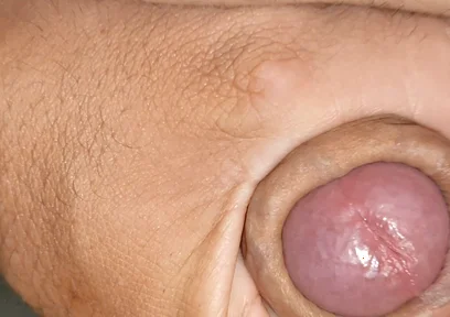 Enjoy the Uncircumcised Welcome Gift.