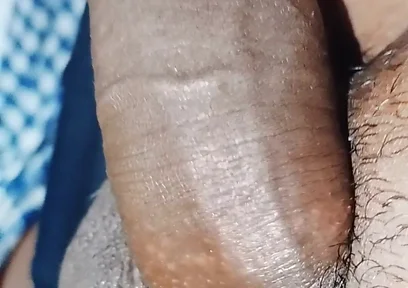 Penis