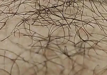 I'm Hairy Boy This My Legs and Dick