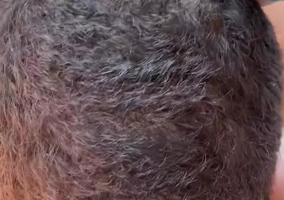 More Sucking
