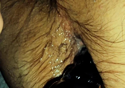Training My Sloppy Hole