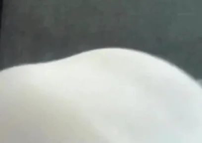 Vertical Argument 4 Tight Dress