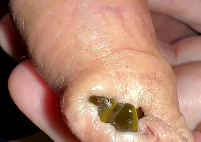 Juicy Small Cock Foreskin Games