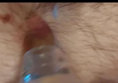 A Close-up Shot of My Belly Button as I Play with It