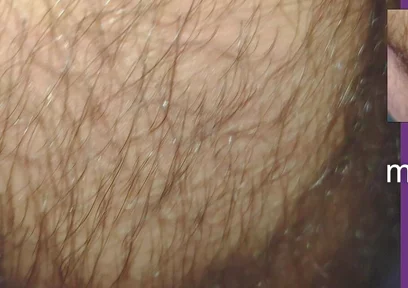 The Texture of the Clothes