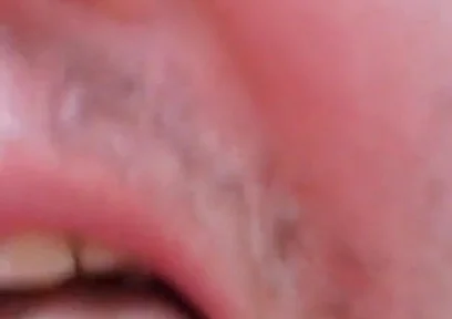 Camera Blunder in the Attempt at Facial Insemination