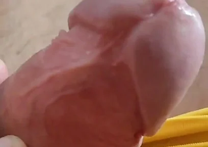 Scarred Frenulum Causes Glans Erection!