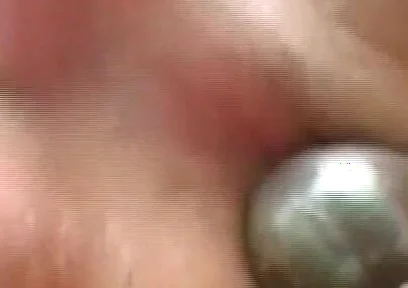 Gaping Anal Rosebud Prolapsing After Deep Stretching Session