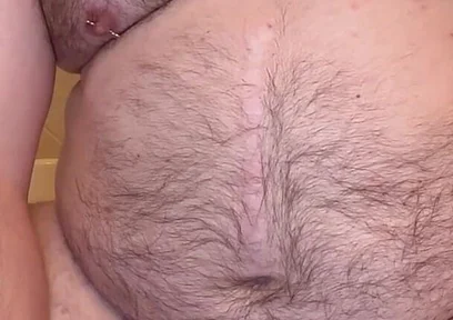 Pierced Chubby Guy Sounding with 3mm - 4mm and 5mm - 6mm Hegar