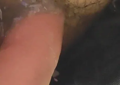 Uncircumcised Phimosis Has the First Ejaculation.